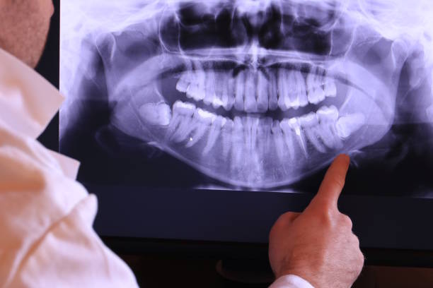 Best Emergency Cosmetic Dentistry in Channel Islands Beach, CA